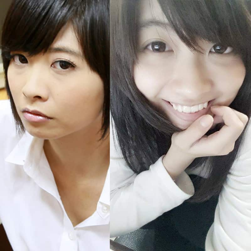 瘋狂女假面-小希 自體脂肪補 淚溝 實記